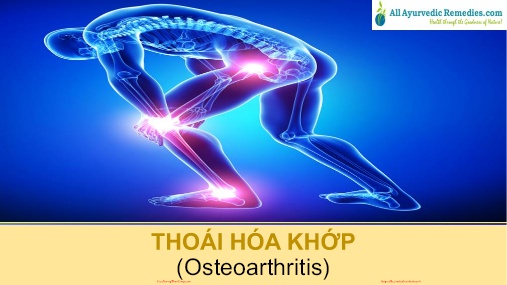 Bài giảng Thoái hóa khớp